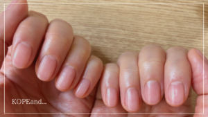 セルフでネイルケアをした様子。爪も短く清潔感のある手元。