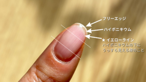 爪に1/3の分割した線とフリーエッジ、ハイポニキウム、イエローラインが分かるように矢印でしるしをつけている爪のアップ